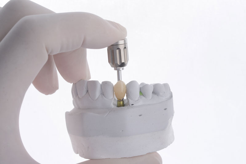a single dental implant model with one implant and a tool for placing it